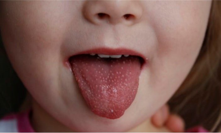 Как определить недостаток витамина B12 у ребенка: рекомендации ученых