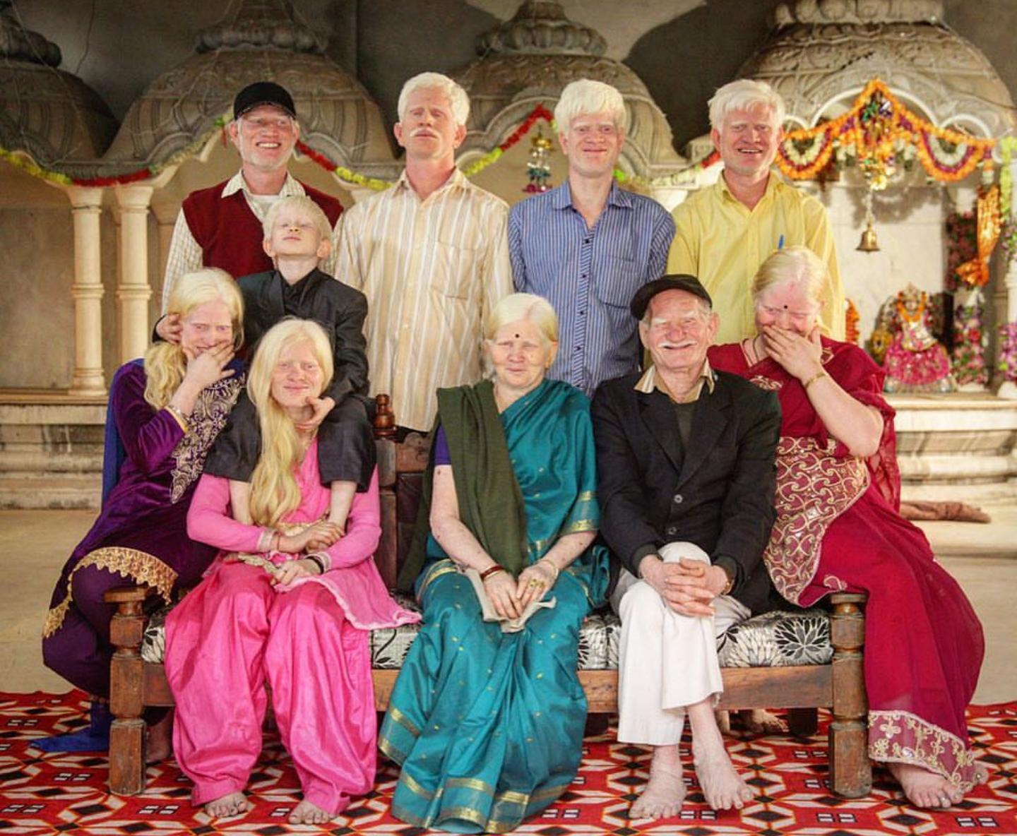 Самая необычная многодетная семья, в которой все альбиносы