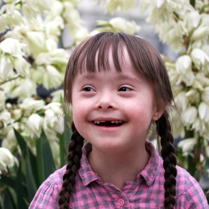 Фотографии детей с синдромом дауна