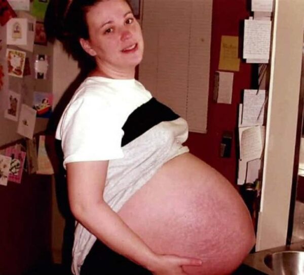 От восьмерняшек до...: самые удивительные случаи многоплодных беременностей в истории