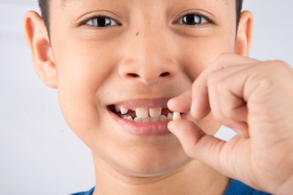 Первый шатающийся зуб у ребенка: что сейчас особенно важно для родителей!