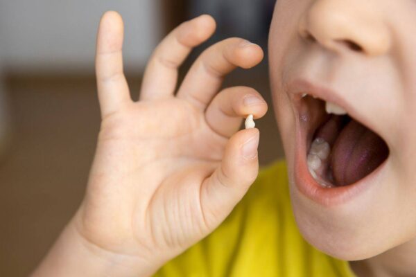 Первый шатающийся зуб у ребенка: что сейчас особенно важно для родителей!