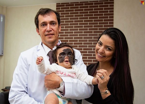 Американской девочке «с маской Бэтмена» в России установили расширители, которые закроют рубцы на ее лице за рекордно короткие сроки: как сейчас выглядит 5-летняя Луна Феннер